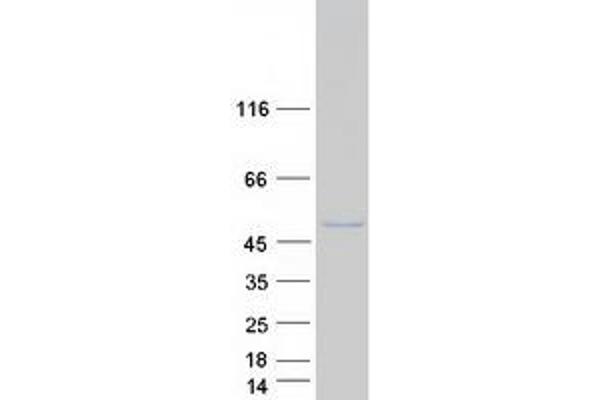 SSBP3 Protein (Transcript Variant 1) (Myc-DYKDDDDK Tag)