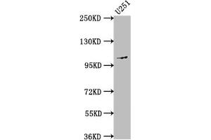 Western Blot Positive WB detected in: U251 whole cell lysate All lanes: MME antibody at 1:1500 Secondary Goat polyclonal to rabbit IgG at 1/50000 dilution Predicted band size: 86 kDa Observed band size: 100 kDa (Recombinant MME 抗体)