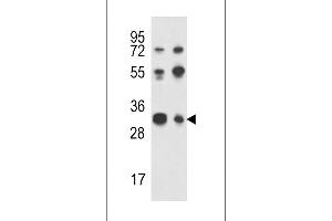 Western blot analysis of RPA43 Antibody in Jurkat,K562 cell line lysates (35ug/lane) (TWIST Neighbor 抗体  (C-Term))