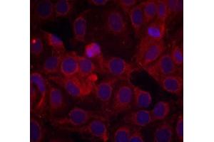 Immunofluorescence staining of methanol-fixed MCF7 cells using VEGFR2 (phospho-Tyr1175) antibody (E011084, Red) (VEGFR2/CD309 抗体  (pTyr1175))