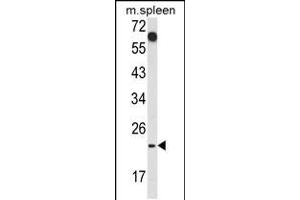 Western blot analysis of CD7 Antibody in mouse spleen tissue lysates (35ug/lane) (CD7 抗体  (AA 65-91))