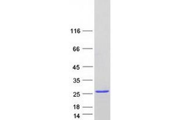 PRKRIP1 Protein (Myc-DYKDDDDK Tag)