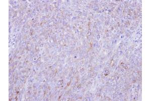 IHC-P Image Immunohistochemical analysis of paraffin-embedded DLD-1 xenograft, using Glypican-1, antibody at 1:100 dilution. (GPC1 抗体)