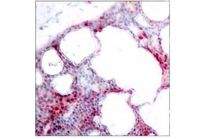 Image no. 1 for anti-Activating Transcription Factor 2 (ATF2) (pSer44), (pSer62) antibody (ABIN196662) (ATF2 抗体  (pSer44, pSer62))