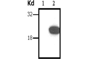 Image no. 1 for anti-DIRAS Family, GTP-Binding RAS-Like 3 (DIRAS3) antibody (ABIN790752) (DIRAS3 抗体)