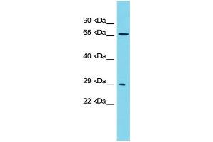 Host: Rabbit Target Name: CCDC124 Sample Type: 293T Whole Cell lysates Antibody Dilution: 1. (CCDC124 抗体  (N-Term))