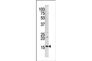 Image no. 1 for anti-Histone 3 (H3) (pSer10) antibody (ABIN358063) (Histone 3 抗体  (pSer10))