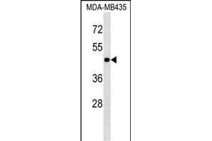 PK3 Antibody (ABIN1539804 and ABIN2843791) western blot analysis in MDA-M cell line lysates (35 μg/lane). (ERK1 抗体)