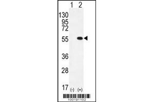 Western blot analysis of PRMT2 using rabbit polyclonal PRMT2 Antibody (L359) using 293 cell lysates (2 ug/lane) either nontransfected (Lane 1) or transiently transfected (Lane 2) with the PRMT2 gene. (PRMT2 抗体  (C-Term))