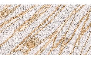 Human skeletal muscle: immunohistochemical staining on a frozen longitudinal section. (Dystroglycan 抗体  (C-Term))