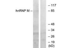Western blot analysis of extracts from HT-29 cells, using hnRNP M Antibody. (HNRNPM 抗体  (AA 11-60))
