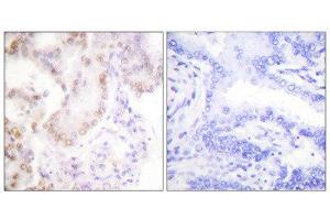 Immunohistochemistry (IHC) image for anti-Cyclin G1 (CCNG1) (Internal Region) antibody (ABIN1848500) (Cyclin G1 抗体  (Internal Region))