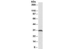 Western blot testing of rat skeletal muscle lysate with ATPG antibody at 0. (ATPG 抗体)
