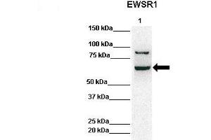 Lanes:   Lane 1: 50ug Hela Lysate  Primary Antibody Dilution:   1:1000  Secondary Antibody:   Anti-rabbit-HRP  Secondary Antibody Dilution:   1:10,000  Gene Name:   EWSR1  Submitted by:   Archa Fox, University of Western Australia  EWSR1 is strongly supported by BioGPS gene expression data to be expressed in Human HeLa cells (EWSR1 抗体  (Middle Region))