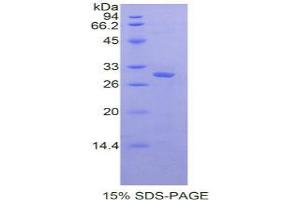 SDS-PAGE analysis of Rat Protein Kinase R Protein. (EIF2AK2 蛋白)