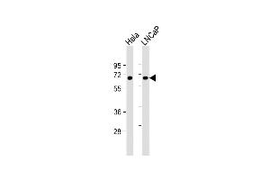 All lanes : Anti-MYC Antibody at 1:1000 dilution Lane 1: Hela whole cell lysate Lane 2: LNCaP whole cell lysate Lysates/proteins at 20 μg per lane. (c-MYC 抗体  (AA 351-380))