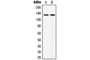 Western blot analysis of ABL1 expression in MCF7 (A), HepG2 (B) whole cell lysates. (ABL1 抗体  (N-Term))