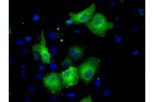 Anti-SORD mouse monoclonal antibody (ABIN2453676) immunofluorescent staining of COS7 cells transiently transfected by pCMV6-ENTRY SORD (RC200415). (SORD 抗体)