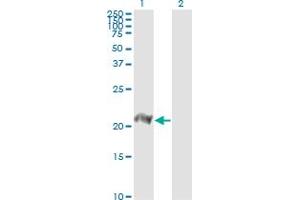 Western Blotting (WB) image for anti-Basic Leucine Zipper ATF-like Transcription Factor (BATF) (AA 34-125) antibody (ABIN564594)