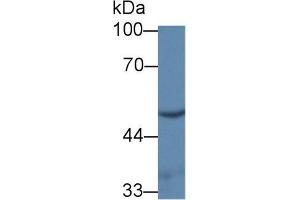 Western blot analysis of Rat Kidney lysate, using Mouse UMPS Antibody (1 µg/ml) and HRP-conjugated Goat Anti-Rabbit antibody ( (UMPS 抗体  (AA 311-481))