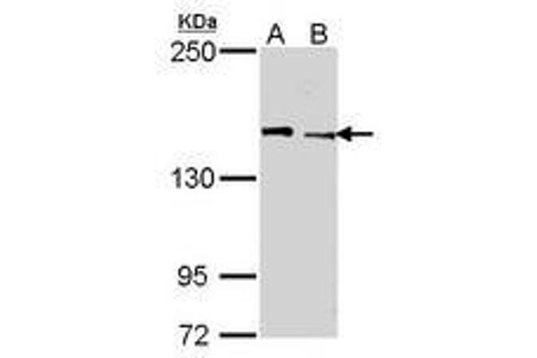 KDM5C 抗体  (AA 10-261)