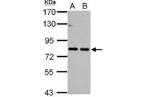 Western Blotting (WB) image for anti-Cortactin (CTTN) (N-Term) antibody (ABIN2854674)