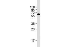 Western blot testing of HeLa cell lysate with Natriuretic Peptide Receptor C antibody at 1:2000. (NPR3 抗体  (AA 200-420))