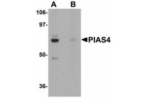 Image no. 1 for anti-Protein Inhibitor of Activated STAT, 4 (PIAS4) (N-Term) antibody (ABIN478293) (PIAS4 抗体  (N-Term))