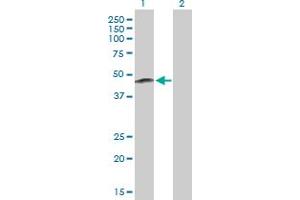 Western Blot analysis of ERAP2 expression in transfected 293T cell line by ERAP2 MaxPab polyclonal antibody. (ERAP2 抗体  (AA 1-350))