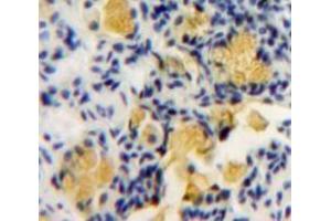 IHC-P analysis of Bowels tissue, with DAB staining. (PKC zeta 抗体  (AA 404-591))