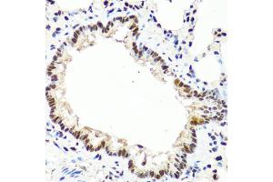 Immunohistochemistry of paraffin-embedded rat lung using TET2 antibody. (TET2 抗体)