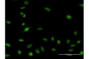 Immunofluorescence of monoclonal antibody to OLIG2 on HeLa cell. (OLIG2 抗体  (AA 2-78))