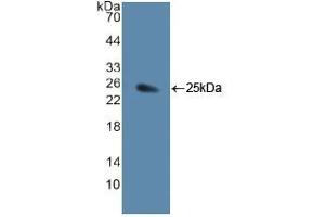 Western Blotting (WB) image for Jagged 1 (JAG1) ELISA Kit (ABIN6730961)