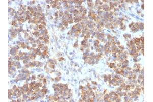 Immunohistochemistry (IHC) image for anti-Tumor Necrosis Factor (Ligand) Superfamily, Member 15 (TNFSF15) antibody (ABIN6941291)