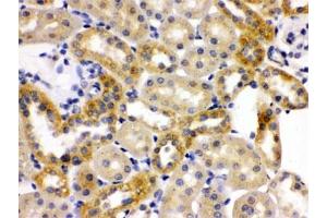 IHC testing of FFPE rat kidney with OPA1 antibody. (OPA1 抗体)