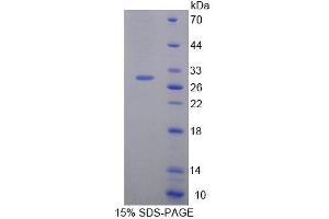 SDS-PAGE analysis of Mouse HAND1 Protein. (HAND1 蛋白)