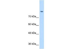 WB Suggested Anti-DLG2 Antibody Titration:  0. (DLG2 抗体  (N-Term))