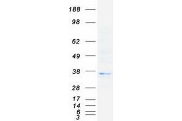 HLA-DOB Protein (Myc-DYKDDDDK Tag)