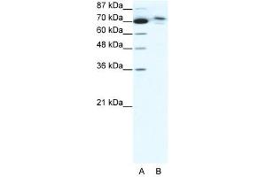 C14ORF101 antibody used at 5 ug/ml to detect target protein. (C14orf101 抗体  (N-Term))