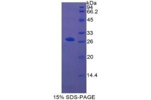 SDS-PAGE (SDS) image for Integrin alpha 2 (ITGA2) ELISA Kit (ABIN6720453)