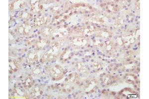 Formalin-fixed and paraffin embedded rat kidney labeled with Rabbit Anti KIFC1 Polyclonal Antibody, Unconjugated (ABIN873143) at 1:200 followed by conjugation to the secondary antibody and DAB staining (KIFC1 抗体)