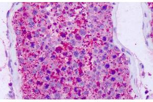 Anti-NPFF2 / NPFFR2 antibody IHC staining of human testis. (NPFFR2 抗体  (C-Term))