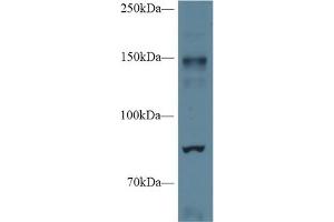 Western Blot; Sample: Mouse Cerebrum lysate; Primary Ab: 1µg/ml Rabbit Anti-Mouse NOS2 Antibody Second Ab: 0. (NOS2 抗体  (AA 43-213))