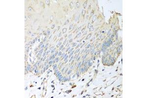 Immunohistochemistry of paraffin-embedded human esophagus using SGCB antibody. (SGCB 抗体)