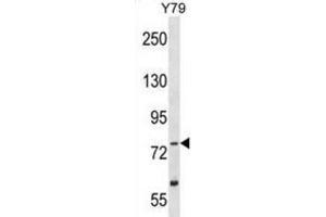 Western Blotting (WB) image for anti-Tousled-Like Kinase 2 (TLK2) antibody (ABIN2995273) (TLK2 抗体)