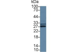 Detection of SPRY3 in Mouse Cerebrum lysate using Polyclonal Antibody to Sprouty Homolog 3 (SPRY3) (SPRY3 抗体  (AA 91-288))