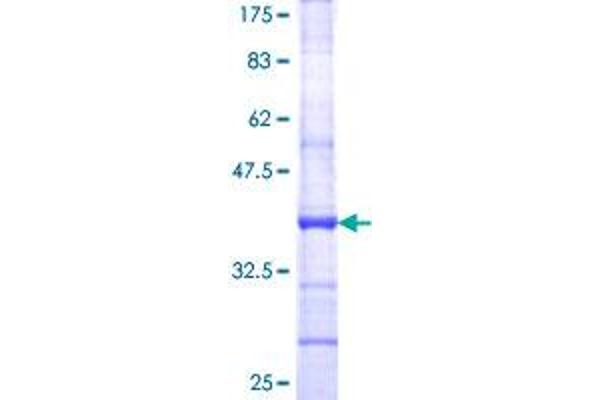 CD6 Protein (CD6) (AA 308-400) (GST tag)