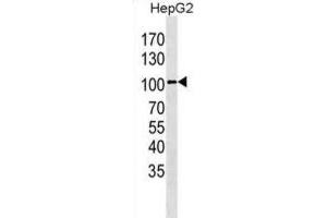 Western Blotting (WB) image for anti-Leucine-Rich Repeat Containing G Protein-Coupled Receptor 5 (LGR5) antibody (ABIN3001607) (LGR5 抗体)