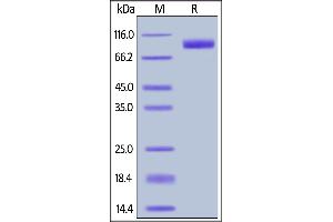 Human Her2, Tag Free on  under reducing (R) condition. (ErbB2/Her2 Protein (AA 23-652))