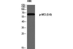 Western Blot (WB) analysis of HBE using p-NF2 (S10) antibody. (Merlin 抗体  (pSer10))